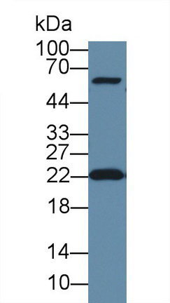 Polyclonal Antibody to Deoxythymidylate Kinase (DTYMK)