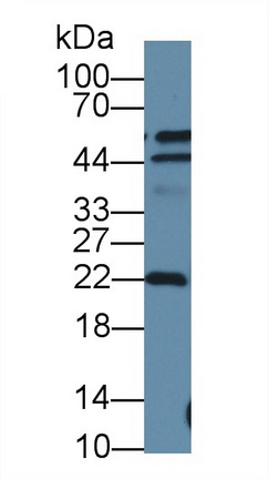 Polyclonal Antibody to Deoxythymidylate Kinase (DTYMK)