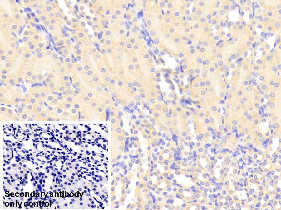 Polyclonal Antibody to Deoxythymidylate Kinase (DTYMK)