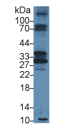 Polyclonal Antibody to Tryptase Beta 2 (TPSb2)