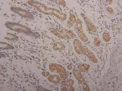 Polyclonal Antibody to Arginase II (Arg2)