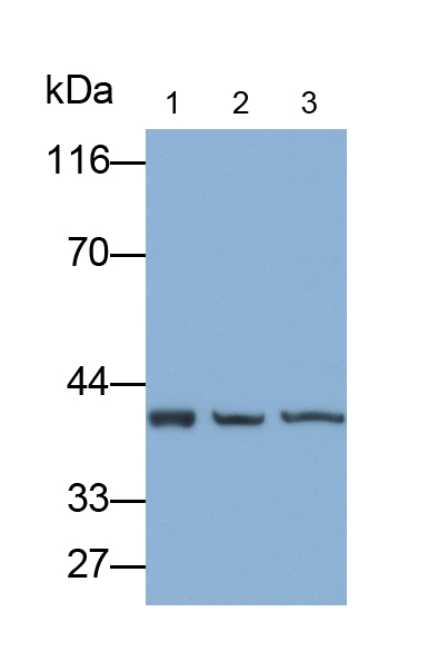 Polyclonal Antibody to Arginase II (Arg2)