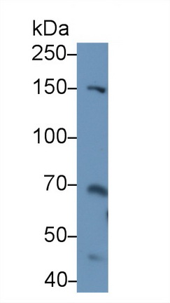 Polyclonal Antibody to Thrombospondin 2 (THBS2)