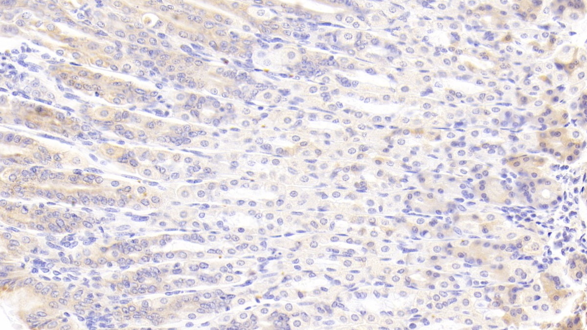 Polyclonal Antibody to Thrombospondin 2 (THBS2)