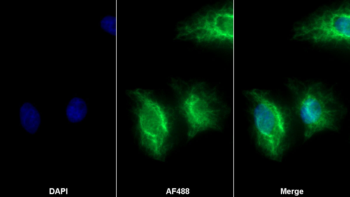 Polyclonal Antibody to Phospholipase A2, Group IIA (PLA2G2A)