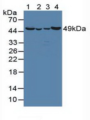 Polyclonal Antibody to Ornithine Aminotransferase (OAT)