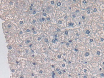 Polyclonal Antibody to Ornithine Aminotransferase (OAT)