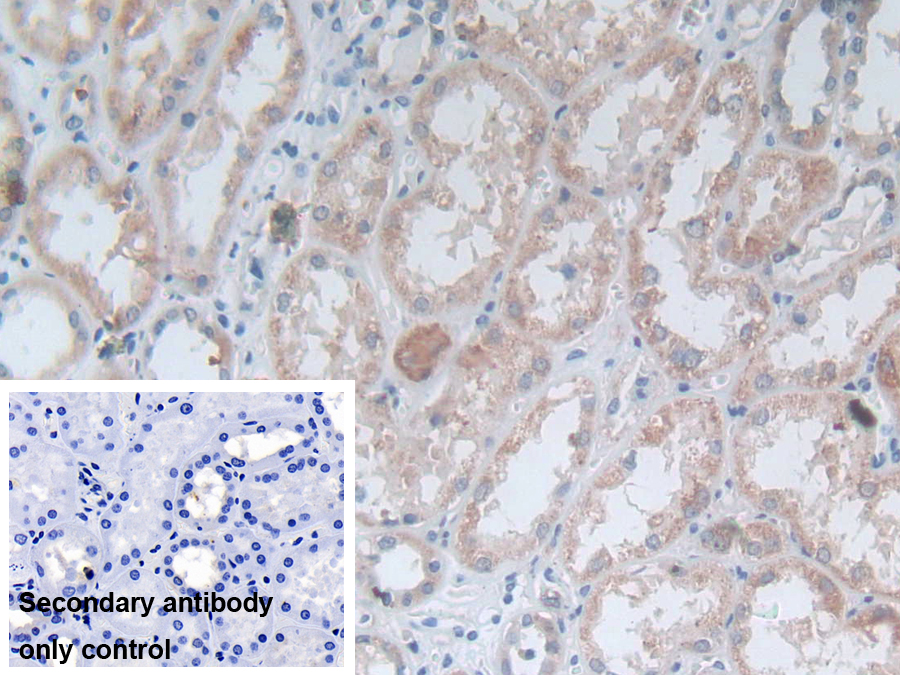 Polyclonal Antibody to Ornithine Aminotransferase (OAT)