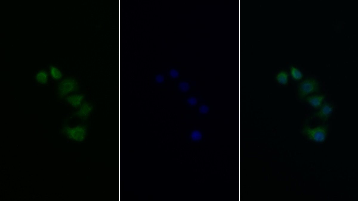 Polyclonal Antibody to Insulin Receptor Substrate 2 (IRS2)