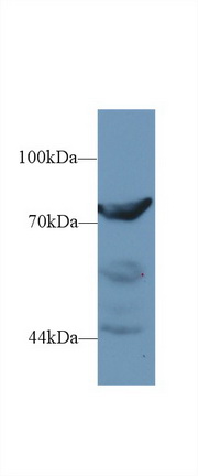 Polyclonal Antibody to Dipeptidyl Peptidase 3 (DPP3)