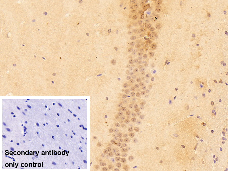 Polyclonal Antibody to Small Nuclear Ribonucleoprotein Polypeptide D3 (SNRPD3)