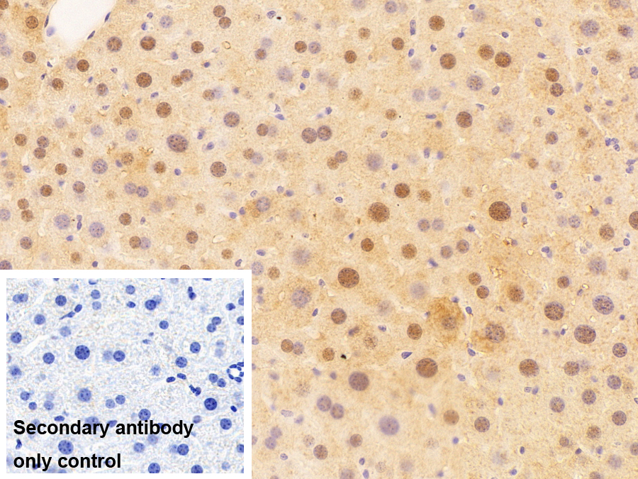 Polyclonal Antibody to Small Nuclear Ribonucleoprotein Polypeptide D3 (SNRPD3)
