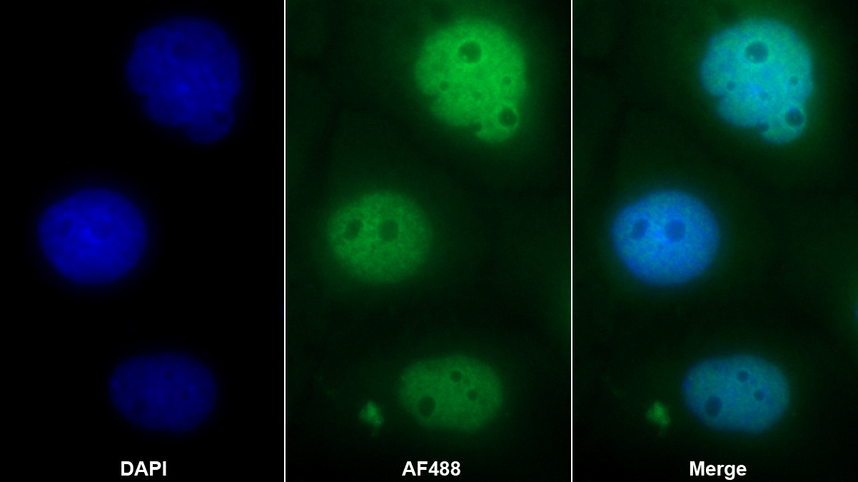 Polyclonal Antibody to Small Nuclear Ribonucleoprotein Polypeptide D3 (SNRPD3)