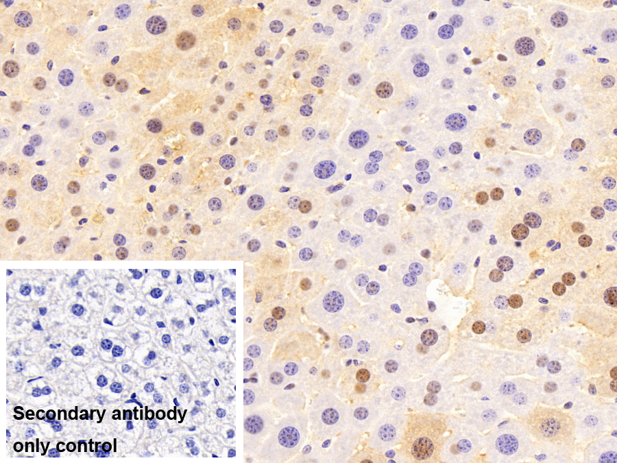 Polyclonal Antibody to Small Nuclear Ribonucleoprotein Polypeptide A (SNRPA)