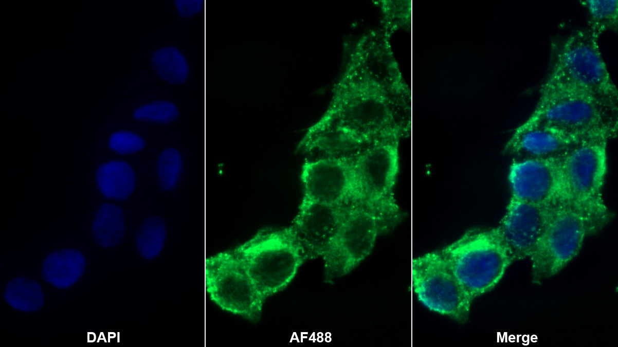 Polyclonal Antibody to Tumor Necrosis Factor Ligand Superfamily, Member 12 (TNFSF12)