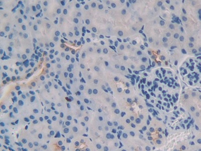 Polyclonal Antibody to Tumor Necrosis Factor Ligand Superfamily, Member 9 (TNFSF9)