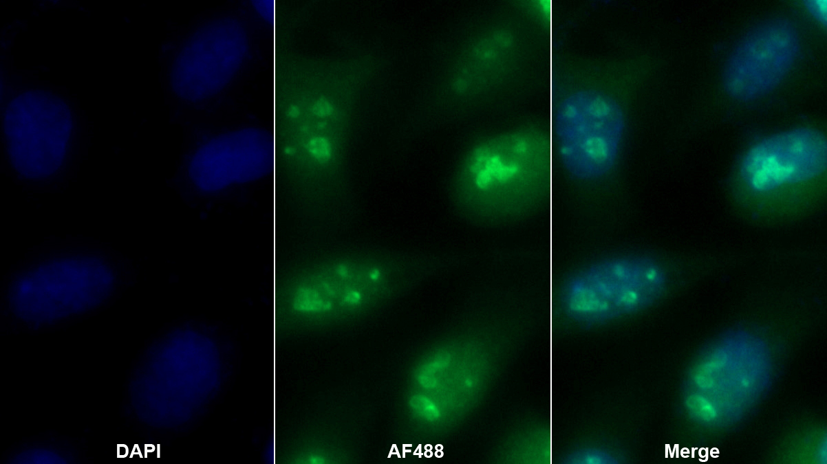 Polyclonal Antibody to Proteasome Assembly Chaperone 2 (PSMG2)