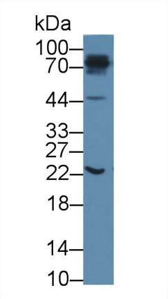 Polyclonal Antibody to 5',3'-Nucleotidase, Cytosolic (NT5C)