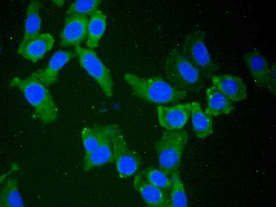 Polyclonal Antibody to 5'-Nucleotidase, Cytosolic III (NT5C3)