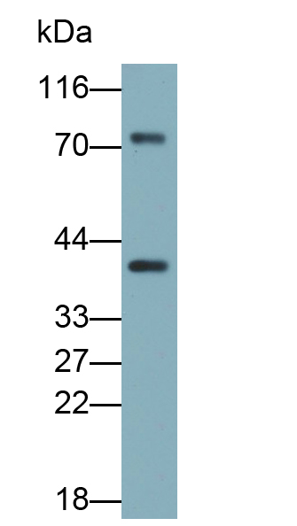 Polyclonal Antibody to 5'-Nucleotidase, Cytosolic III (NT5C3)