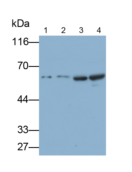 Polyclonal Antibody to RAR Related Orphan Receptor Alpha (RORa)