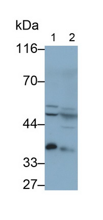 Polyclonal Antibody to Dimethylarginine Dimethylaminohydrolase 2 (DDAH2)