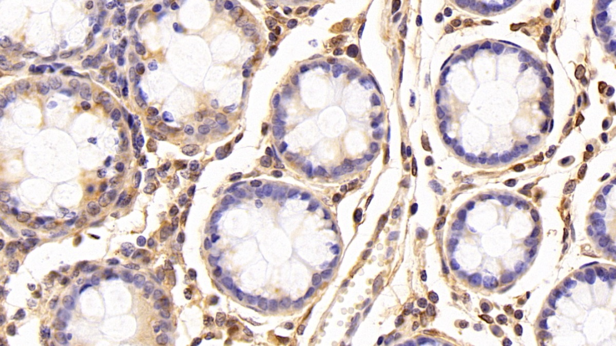 Polyclonal Antibody to Dimethylarginine Dimethylaminohydrolase 2 (DDAH2)