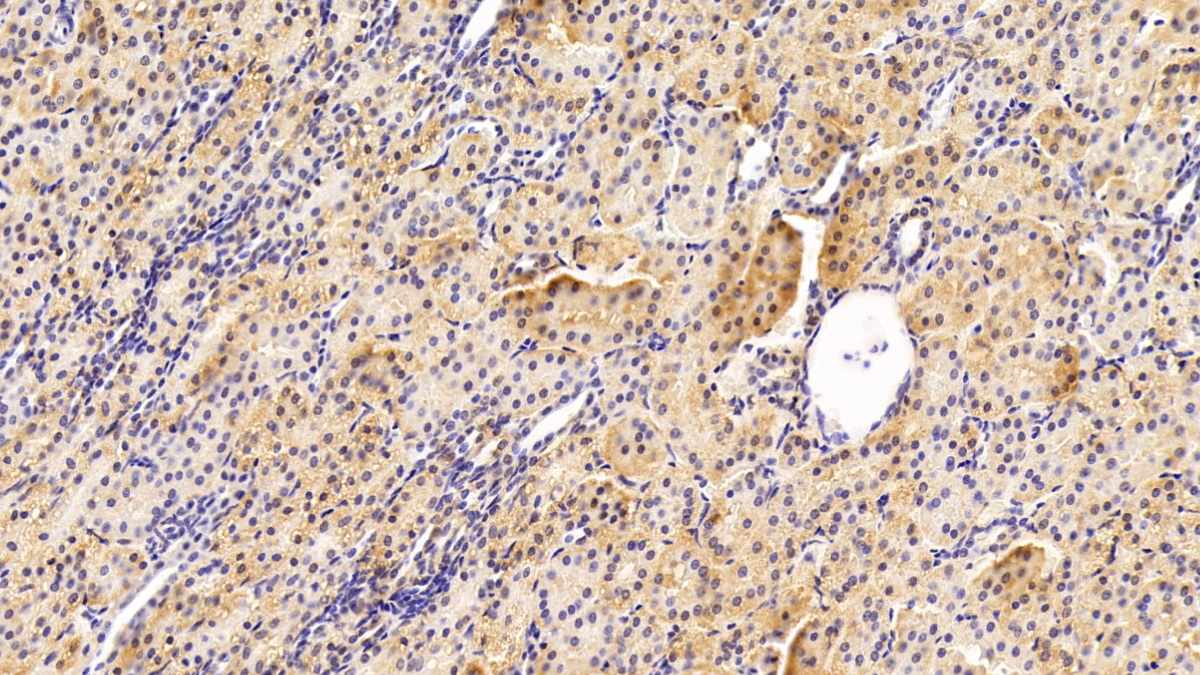 Polyclonal Antibody to Dimethylarginine Dimethylaminohydrolase 2 (DDAH2)