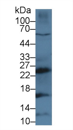 Polyclonal Antibody to Cathepsin G (CTSG)