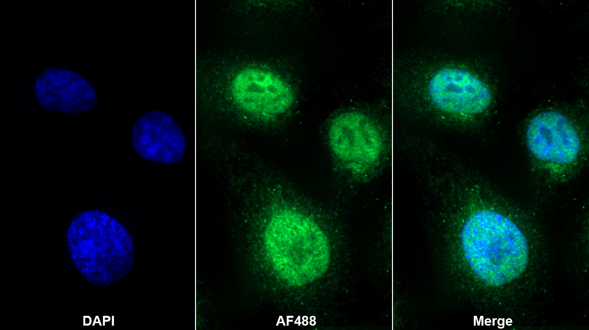 Polyclonal Antibody to CREB Binding Protein (CREBBP)