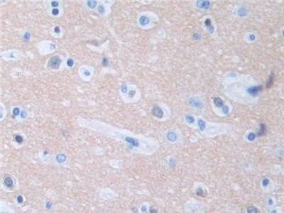 Polyclonal Antibody to Protein Phosphatase 3, Regulatory Subunit 1 (PPP3R1)