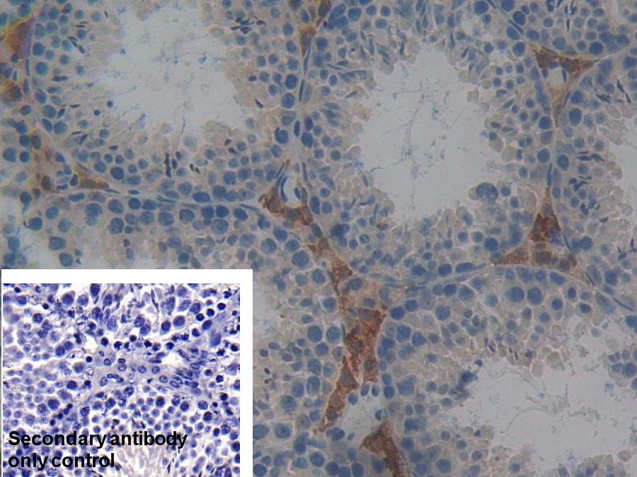 Polyclonal Antibody to Protein Phosphatase 2A Activator, Regulatory Subunit 4 (PPP2R4)