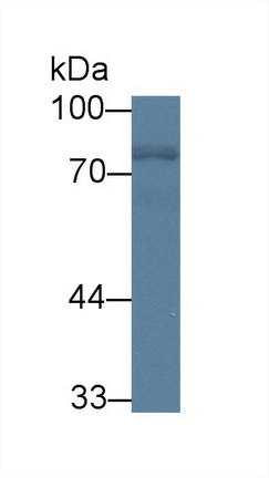 Polyclonal Antibody to Neurofilament, Light Polypeptide (NEFL)