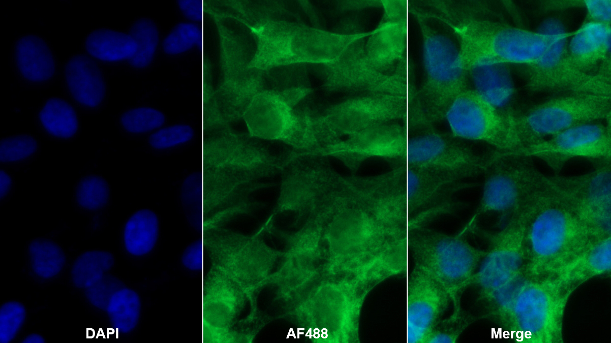 Polyclonal Antibody to Cannabinoid Receptor Interacting Protein 1 (CNRIP1)