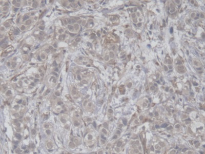 Polyclonal Antibody to Colipase, Pancreatic (CLPS)