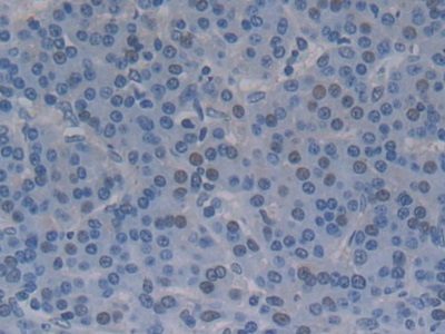 Polyclonal Antibody to Proprotein Convertase Subtilisin/Kexin Type 9 (PCSK9)