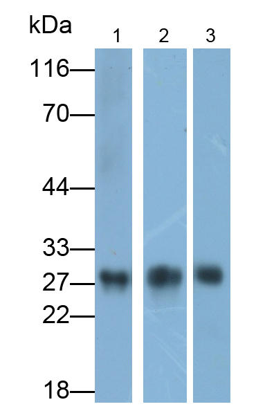 Polyclonal Antibody to Chymotrypsinogen B2 (CTRB2)