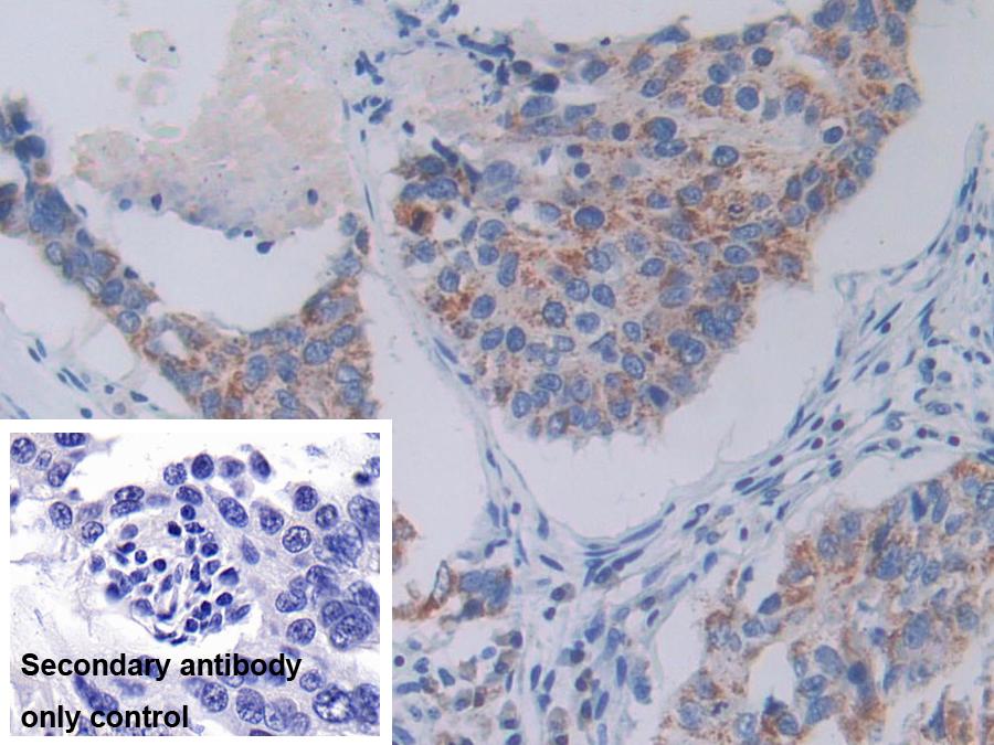 Polyclonal Antibody to Serine Hydroxymethyltransferase 2, Mitochondrial (SHMT2)