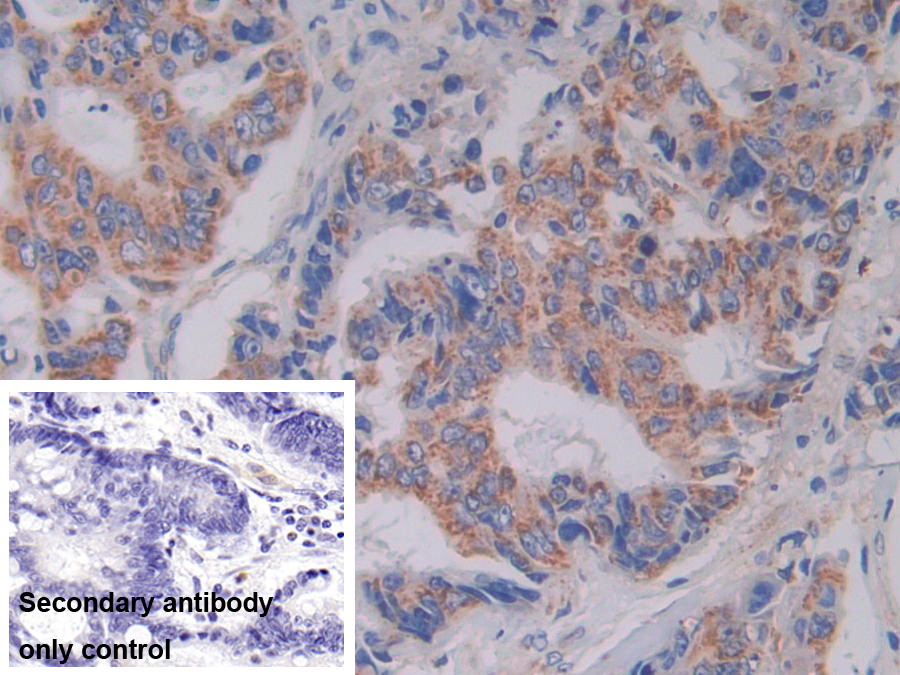 Polyclonal Antibody to Serine Hydroxymethyltransferase 2, Mitochondrial (SHMT2)