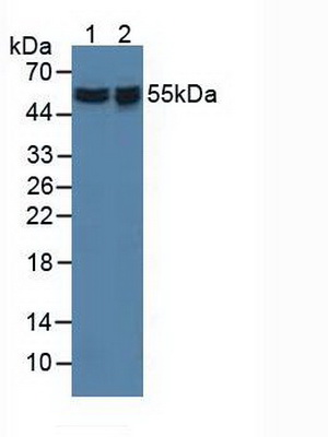 Polyclonal Antibody to Apoptosis Inhibitor 5 (API5)