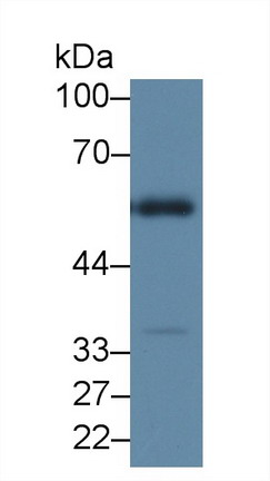 Polyclonal Antibody to Hyaluronoglucosaminidase 2 (HYAL2)