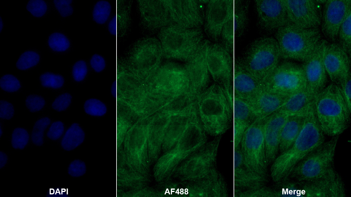 Polyclonal Antibody to Tryptophan-2,3-dioxygenase (TDO)