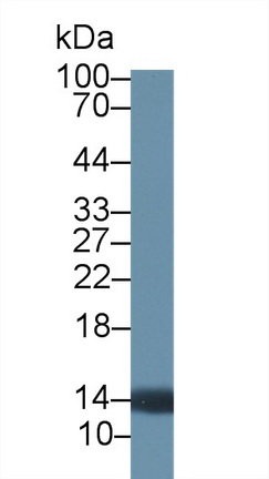 Polyclonal Antibody to Protein Tyrosine Kinase 6 (PTK6)