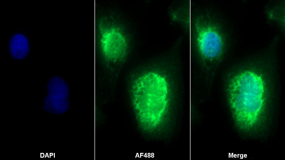 Polyclonal Antibody to Optic Atrophy 1, Autosomal Dominant (OPA1)