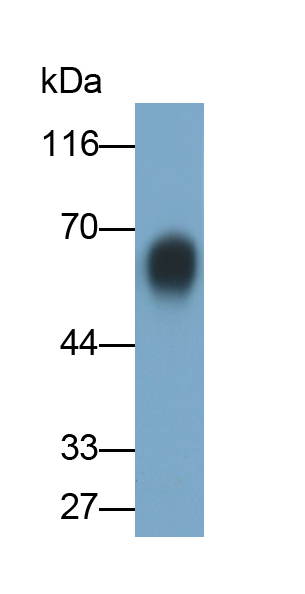 Polyclonal Antibody to Excitatory Amino Acid Transporter 1 (EAAT1)