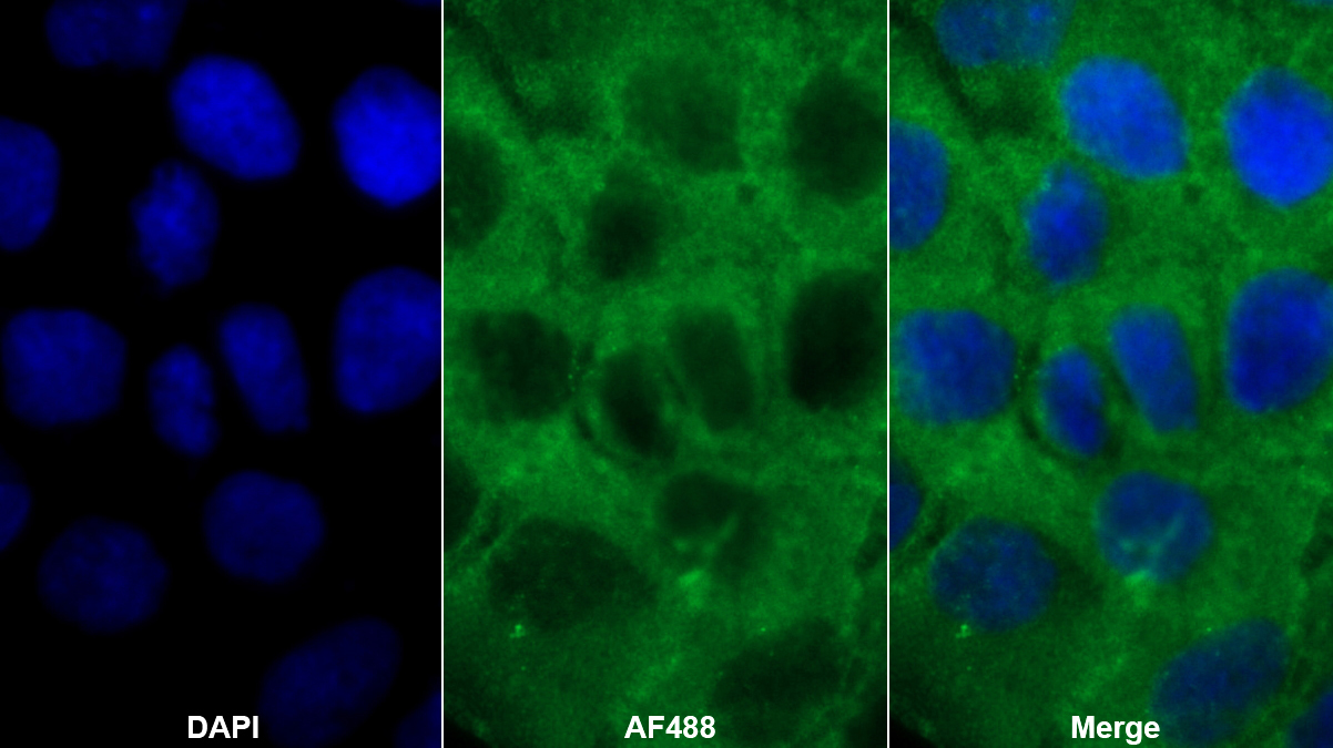Polyclonal Antibody to Fyn Related Kinase (FRK)
