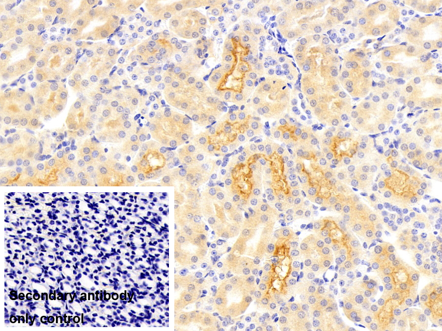 Polyclonal Antibody to Sodium/Glucose Cotransporter 2 (SGLT2)