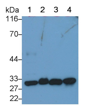 Polyclonal Antibody to Phosphoglycerate Mutase 1, Brain (PGAM1)