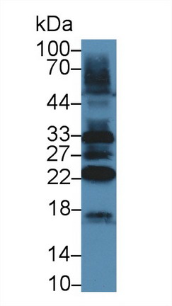 Polyclonal Antibody to Tafazzin (TAZ)