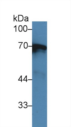 Polyclonal Antibody to Alpha-1-B-Glycoprotein (a1BG)